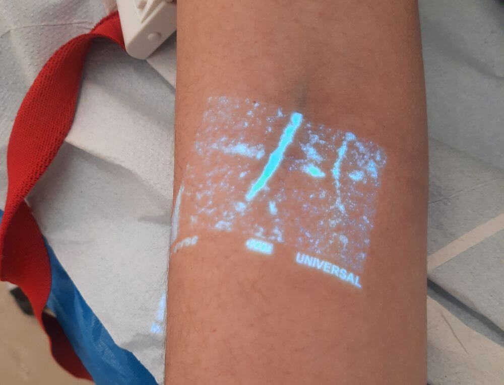 Το μηχάνημα ανίχνευσης φλεβών